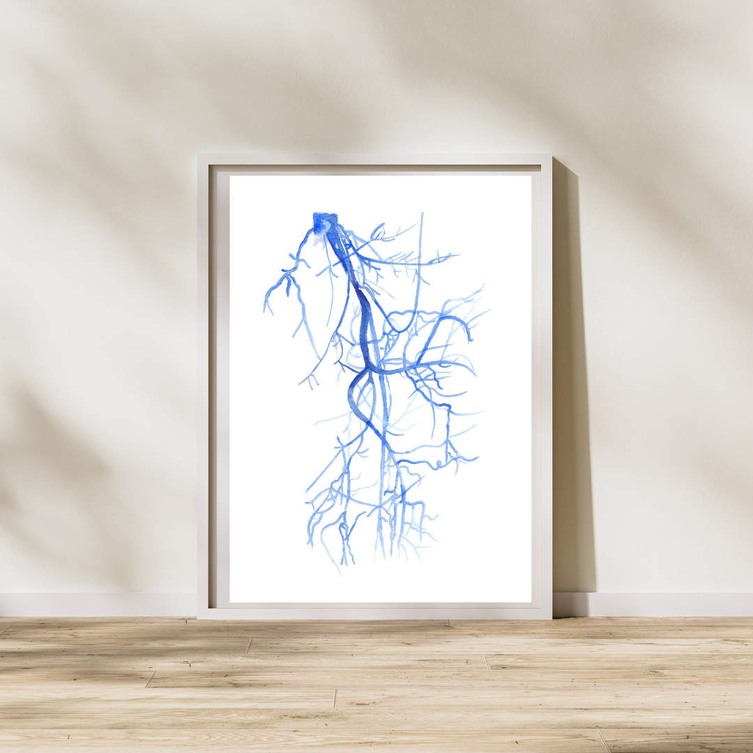 Lower Limb Angiography, Iliofemoral Section, Vascular Surgery and Radiology Art Print