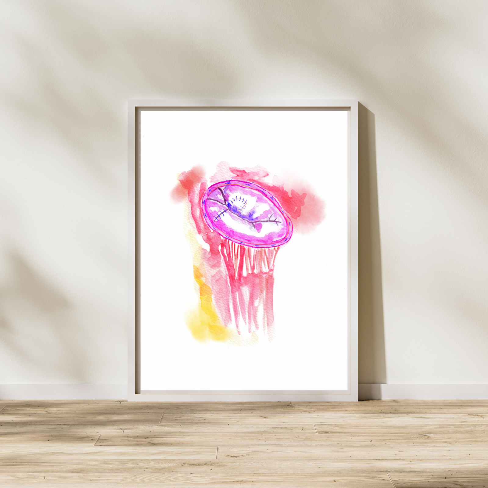 mitral valve replacement surgery art