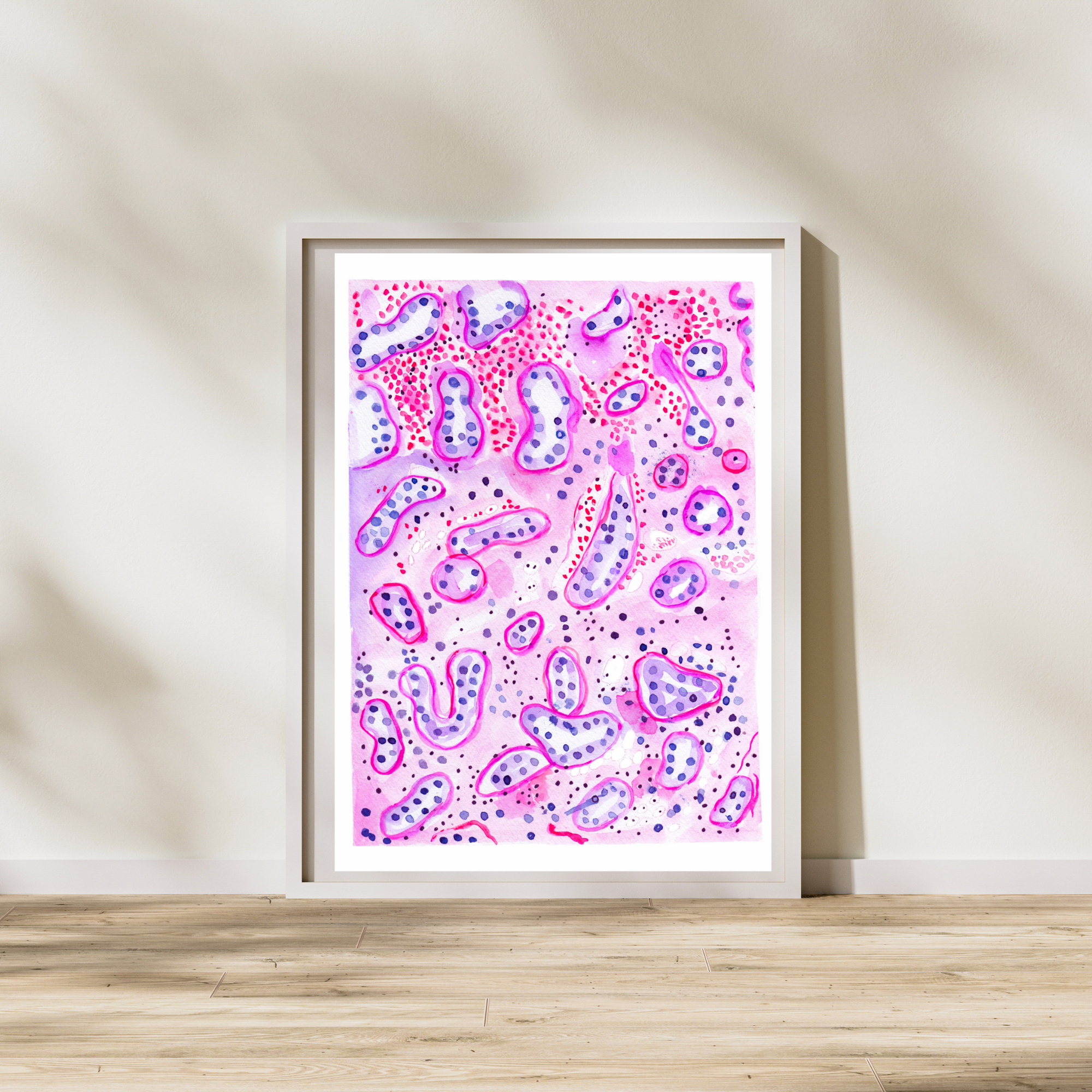 kidney biopsy after transplant with rejection watercolor illustration