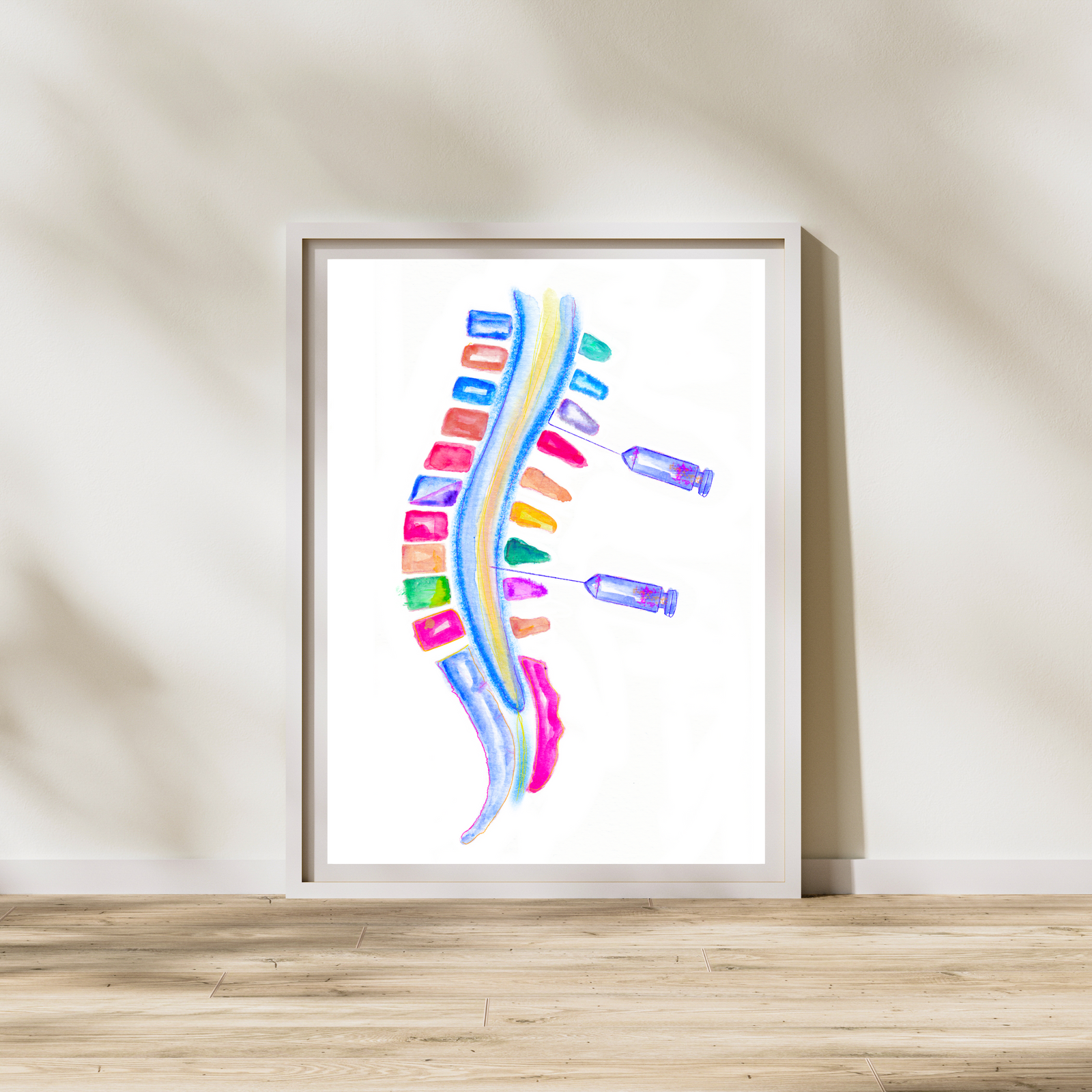Spinal Block vs Epidural Anesthesia Art Print