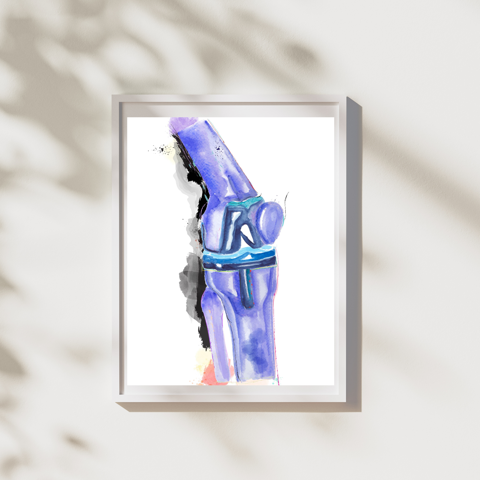 orthopedic surgery art print
