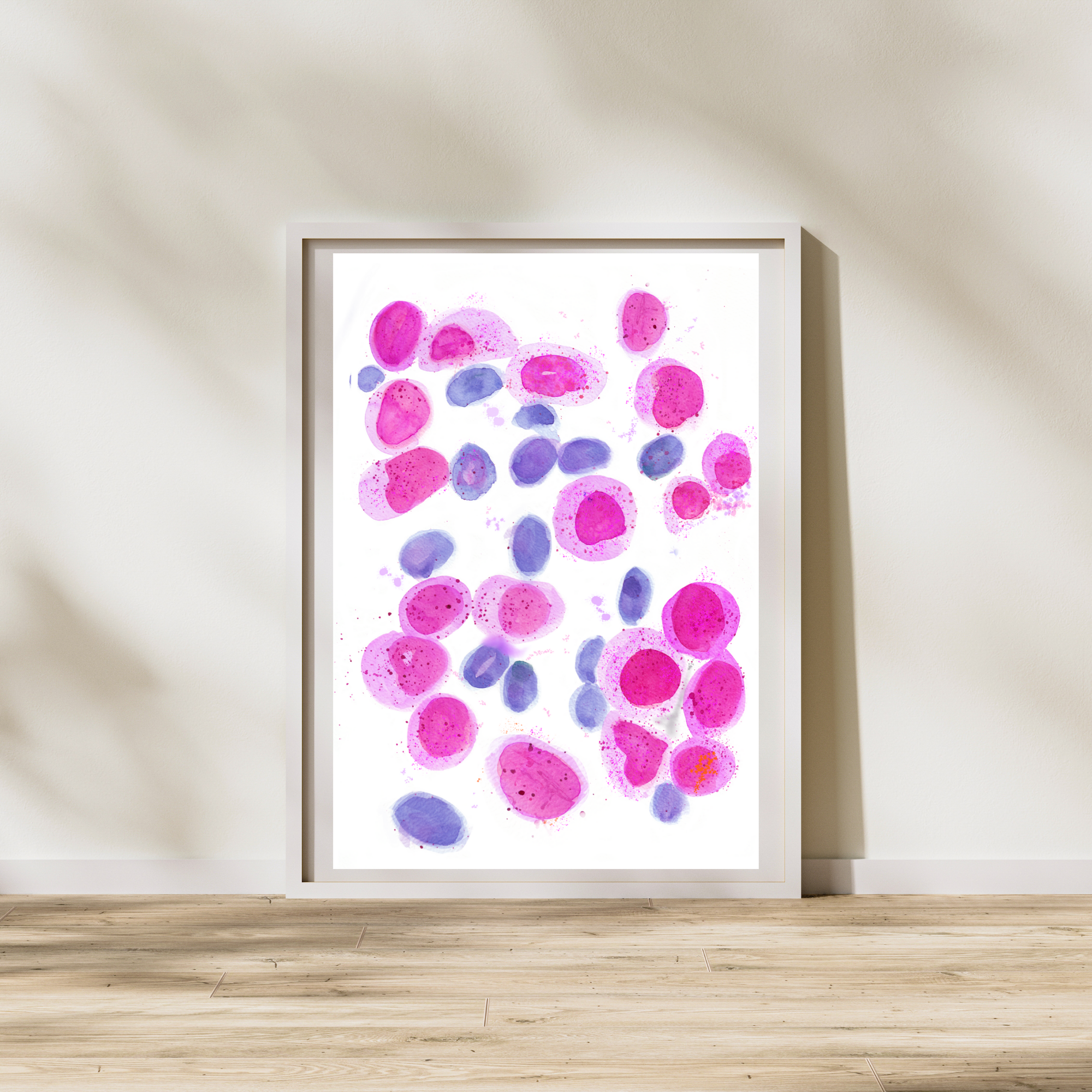 acute myeloid leukemia art
