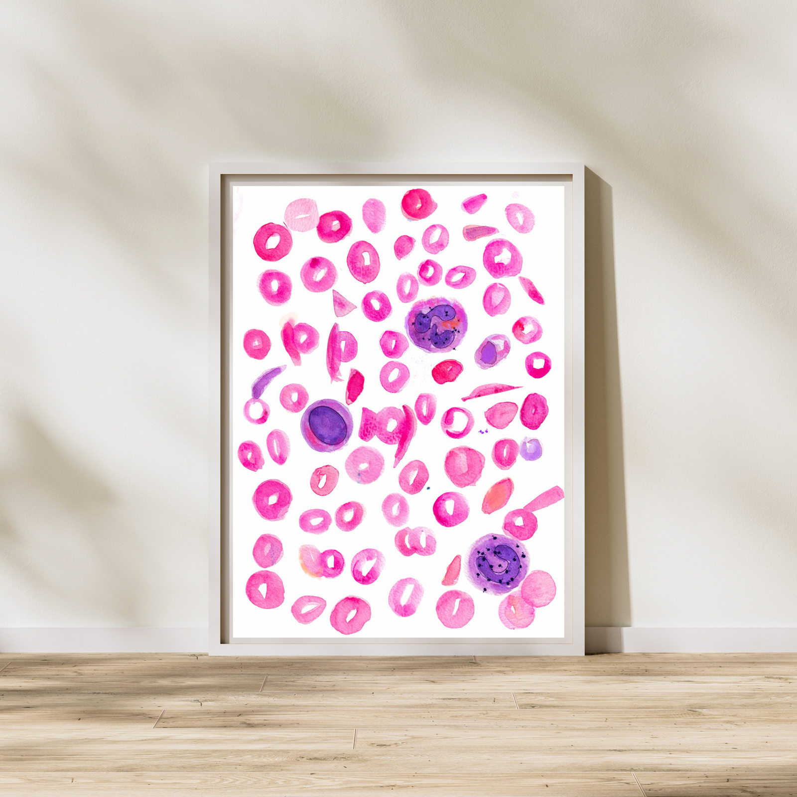 blood cell sickle cell anemia painting
