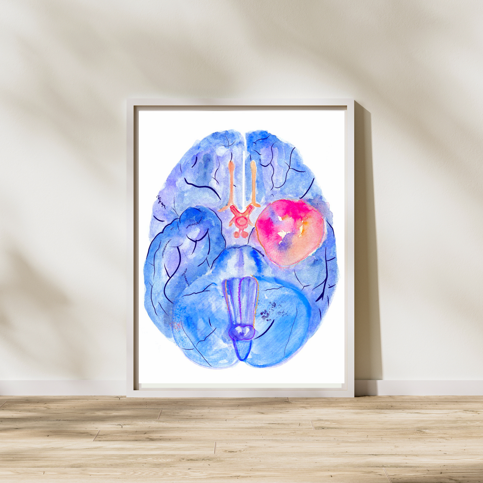 Meningioma Brain Anatomy Watercolor Art Print