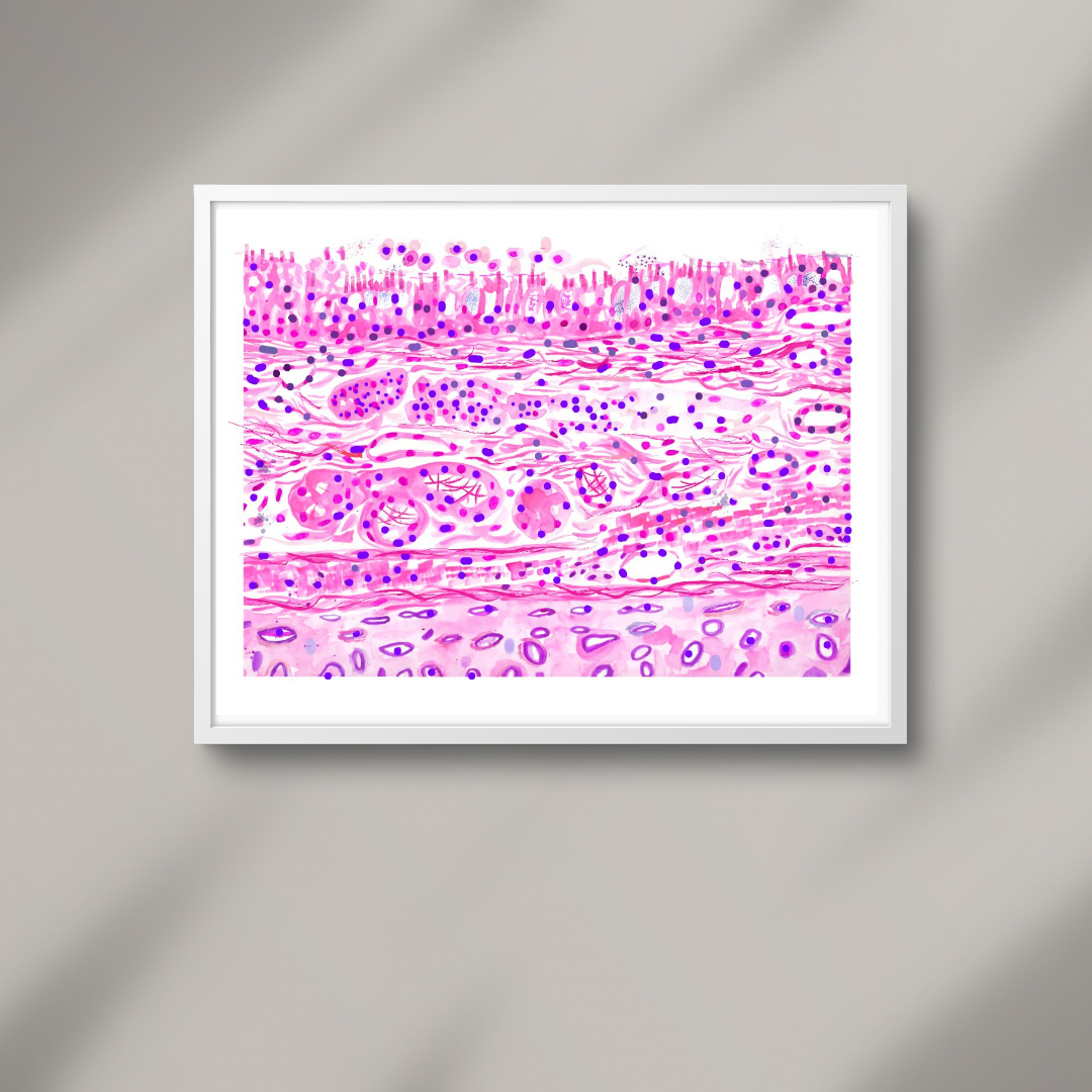 Bronchial Wall Histopathology Art
