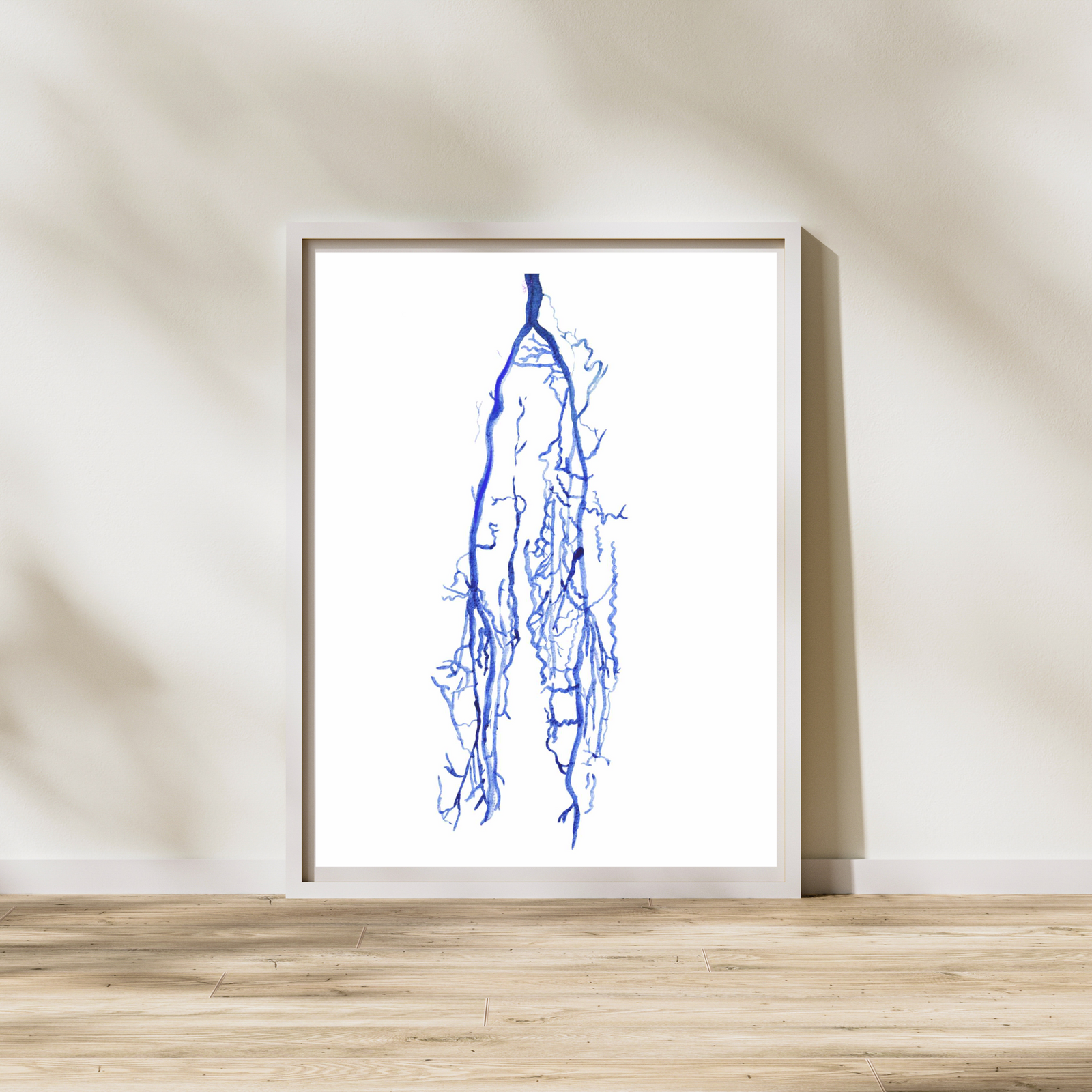 varicose veins painting