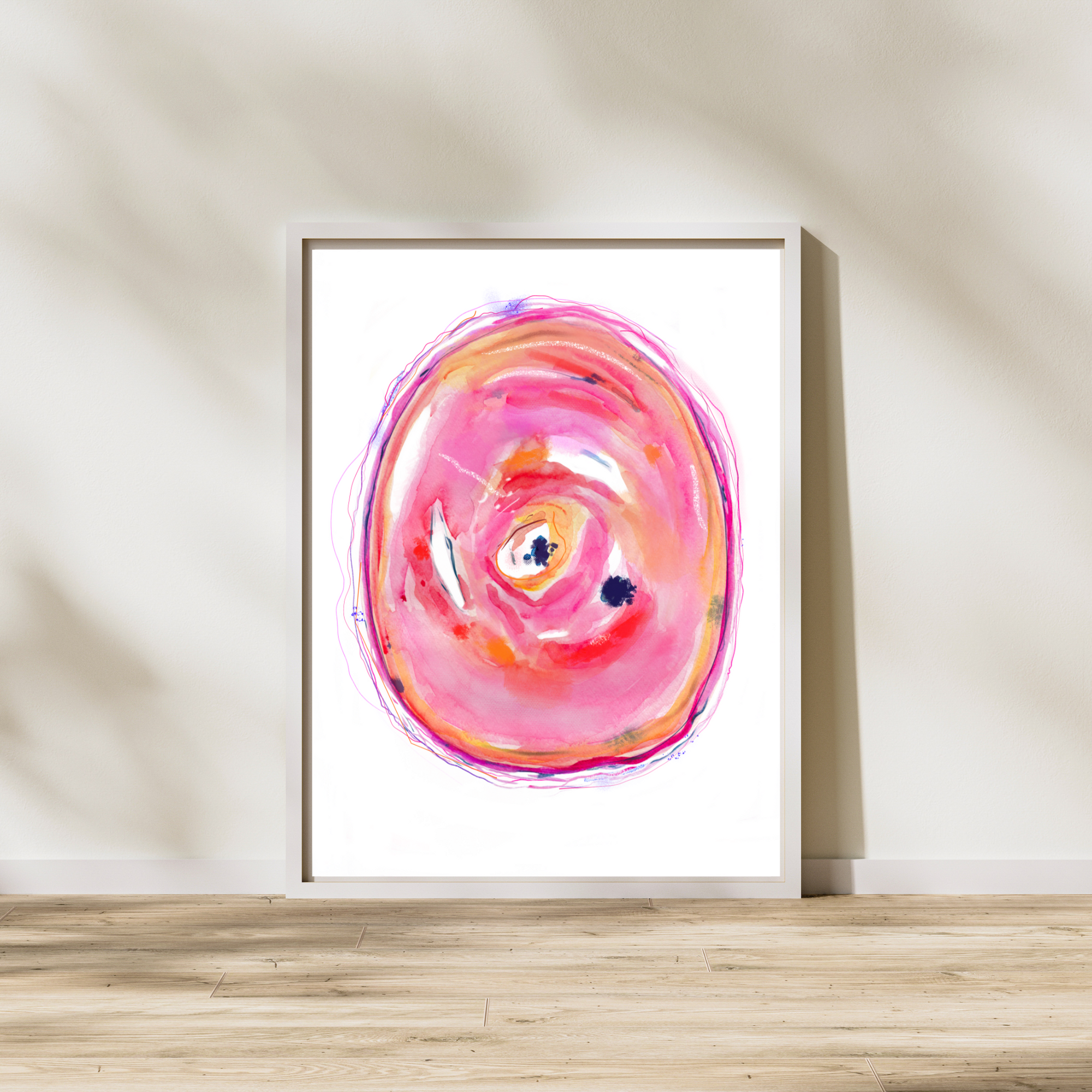 atherosclerotic  artery histology art print