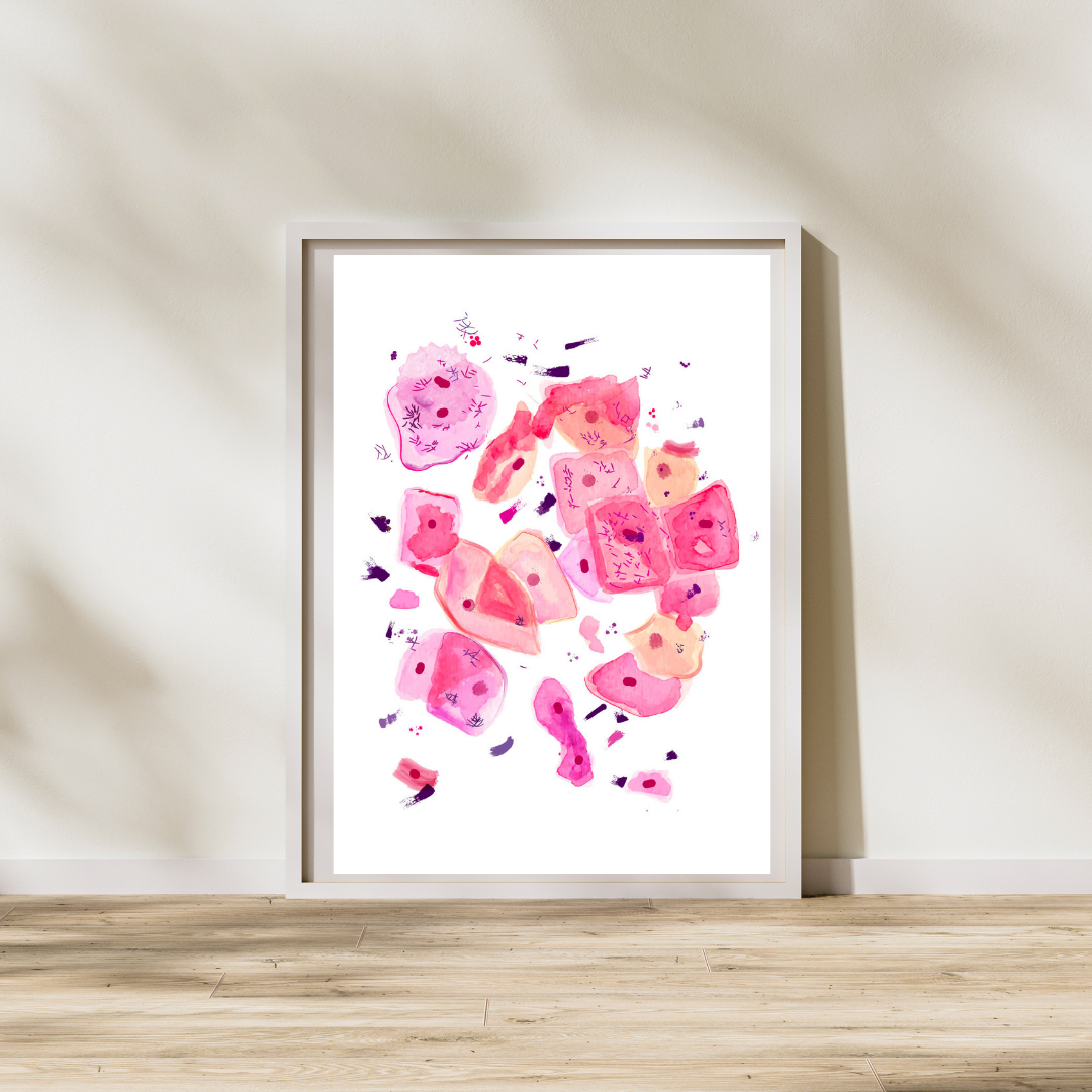 Bacterial Vaginosis Pathology Art Print