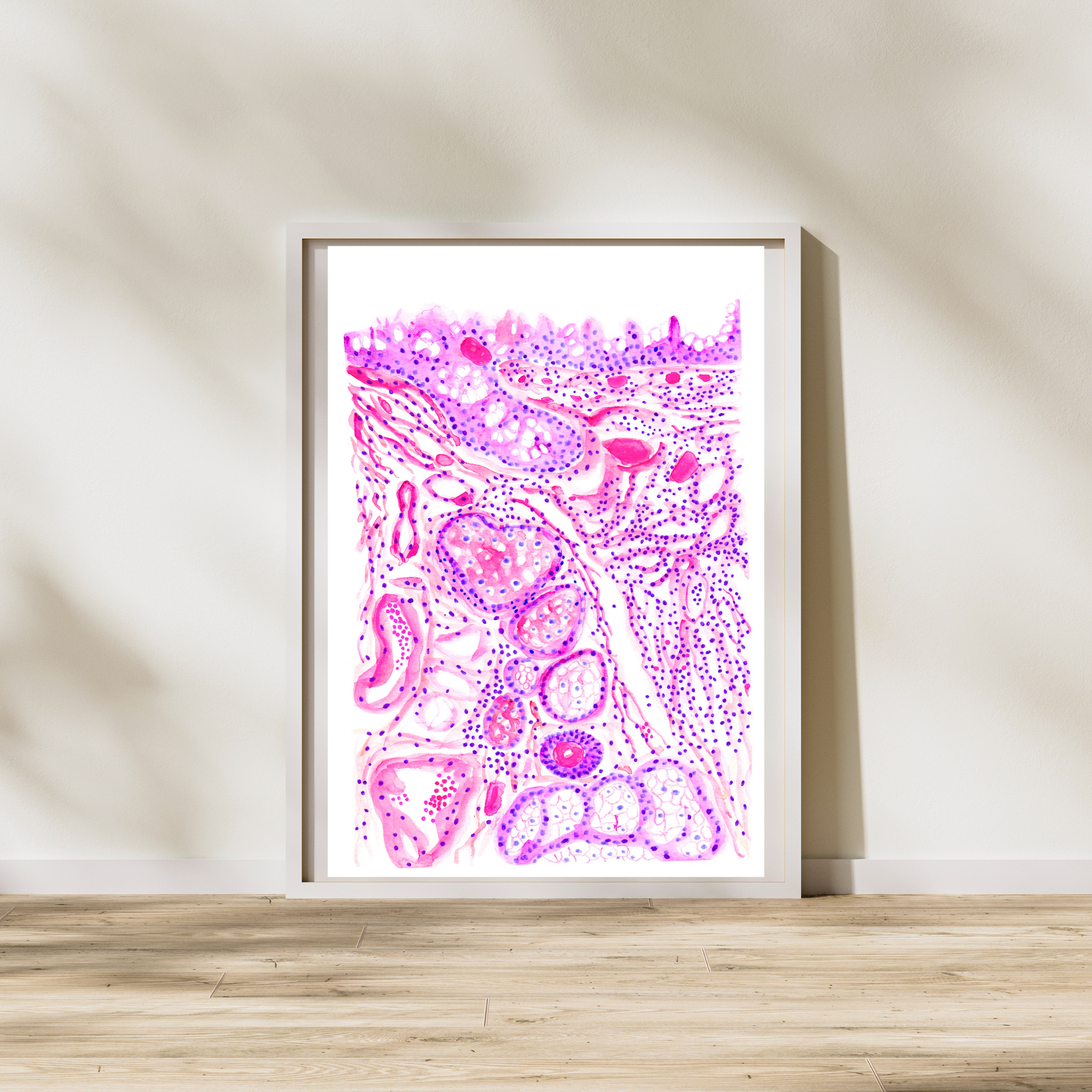 Chronic Conjunctivitis Histopathology Art Print