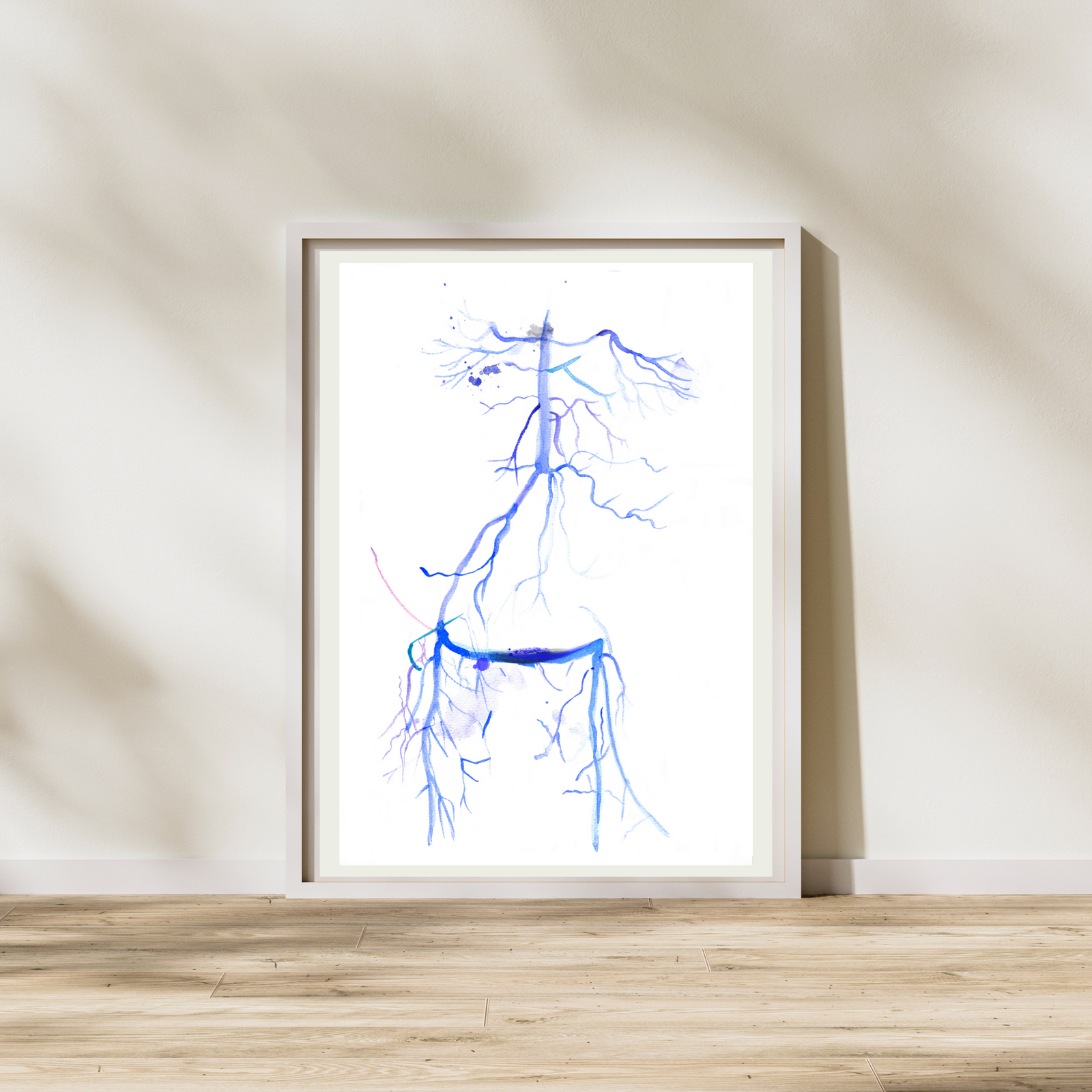 Crossover iliac artery bypass