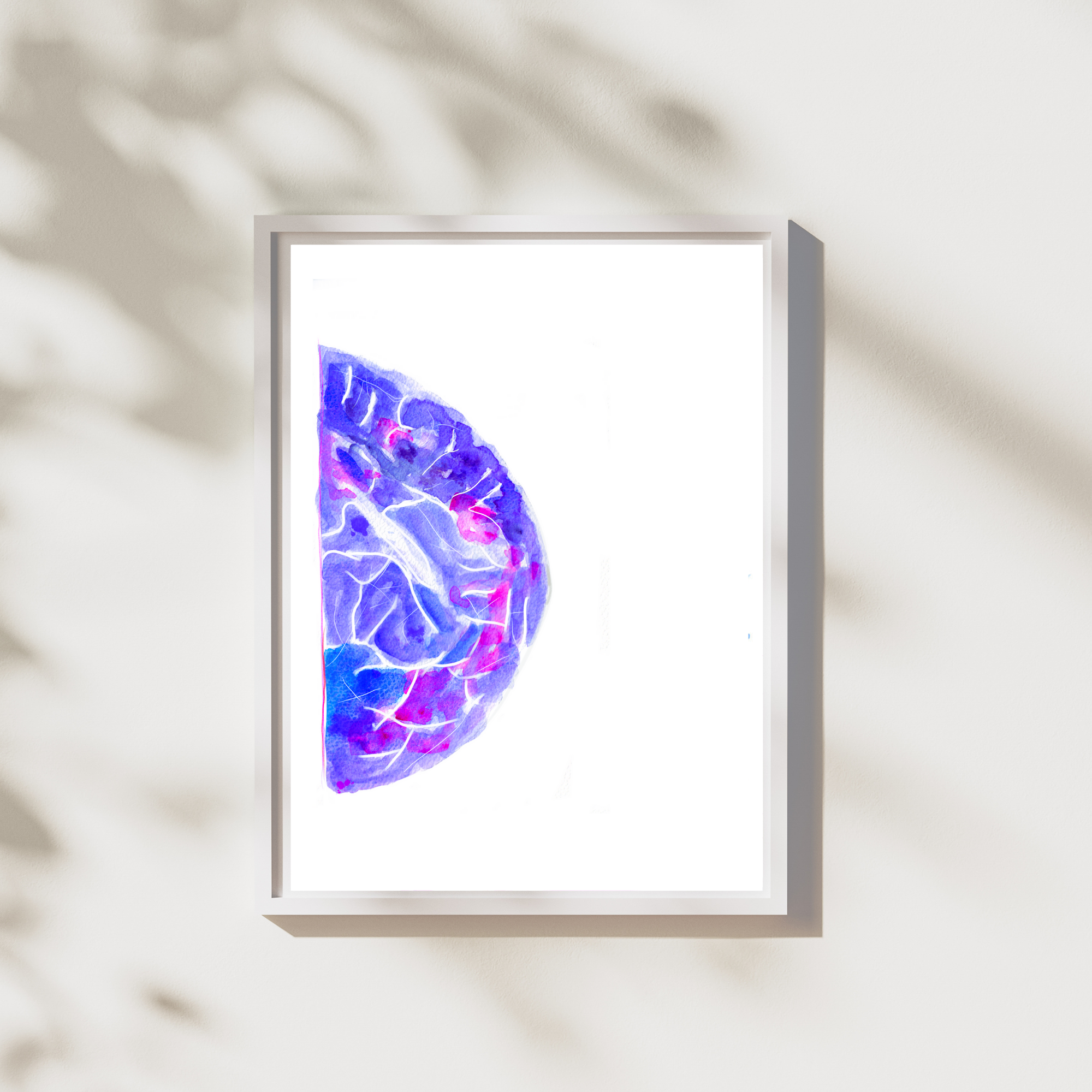 mammography art print