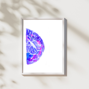 mammography art print