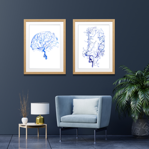 Cerebral Angiography, Cerebral Aneurysm, Set of 2