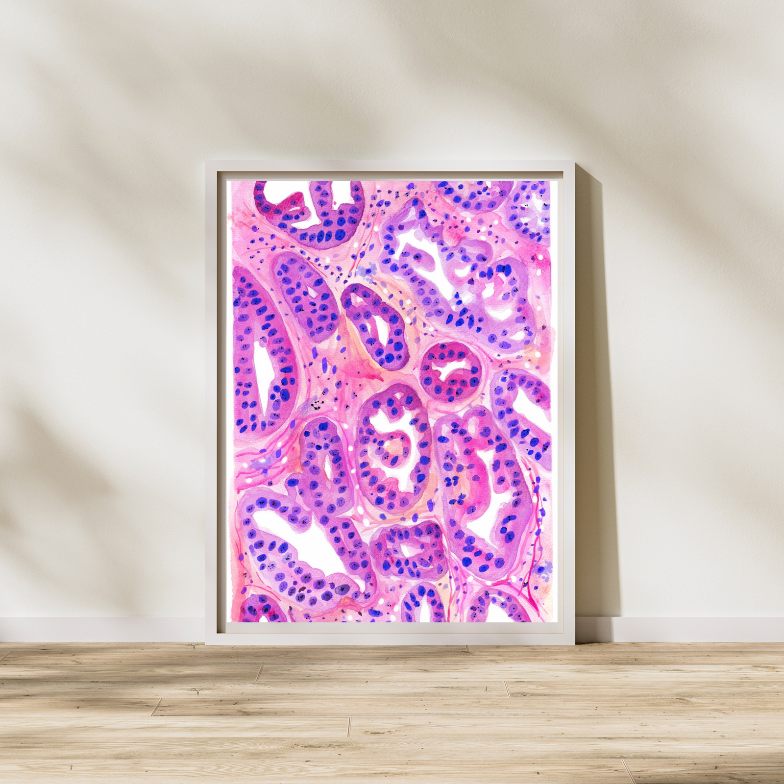 Ovarian Cancer Histopathology Art