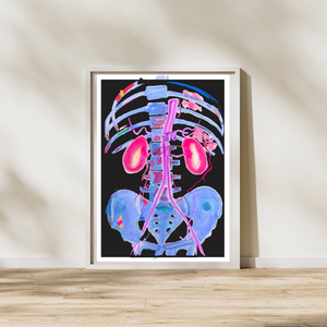 cta abdominal radiology art print
