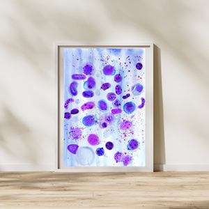 systemic mastocytosis
art print