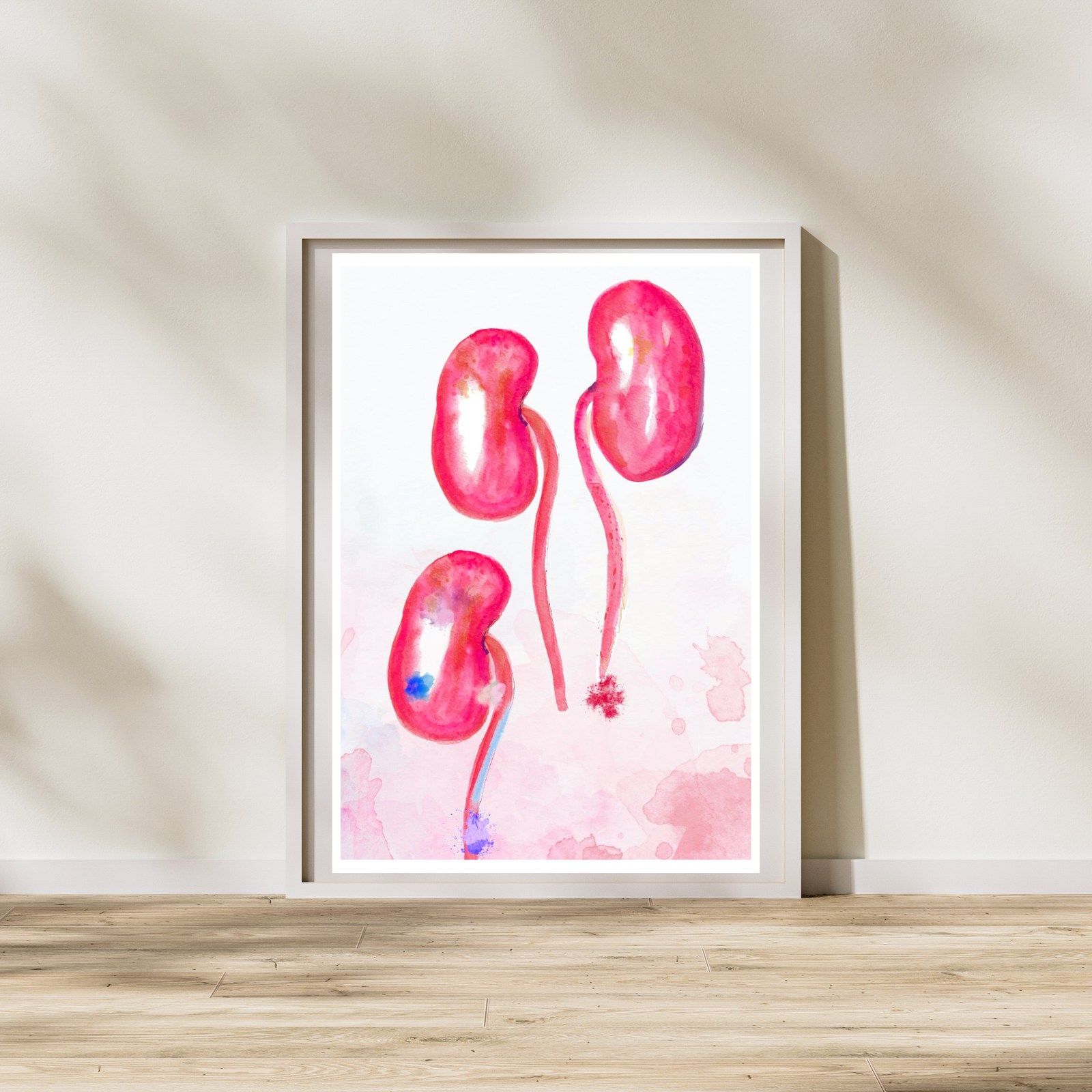 kidney transplant watercolor art print