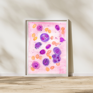 Multiple Myeloma Histopathology Art