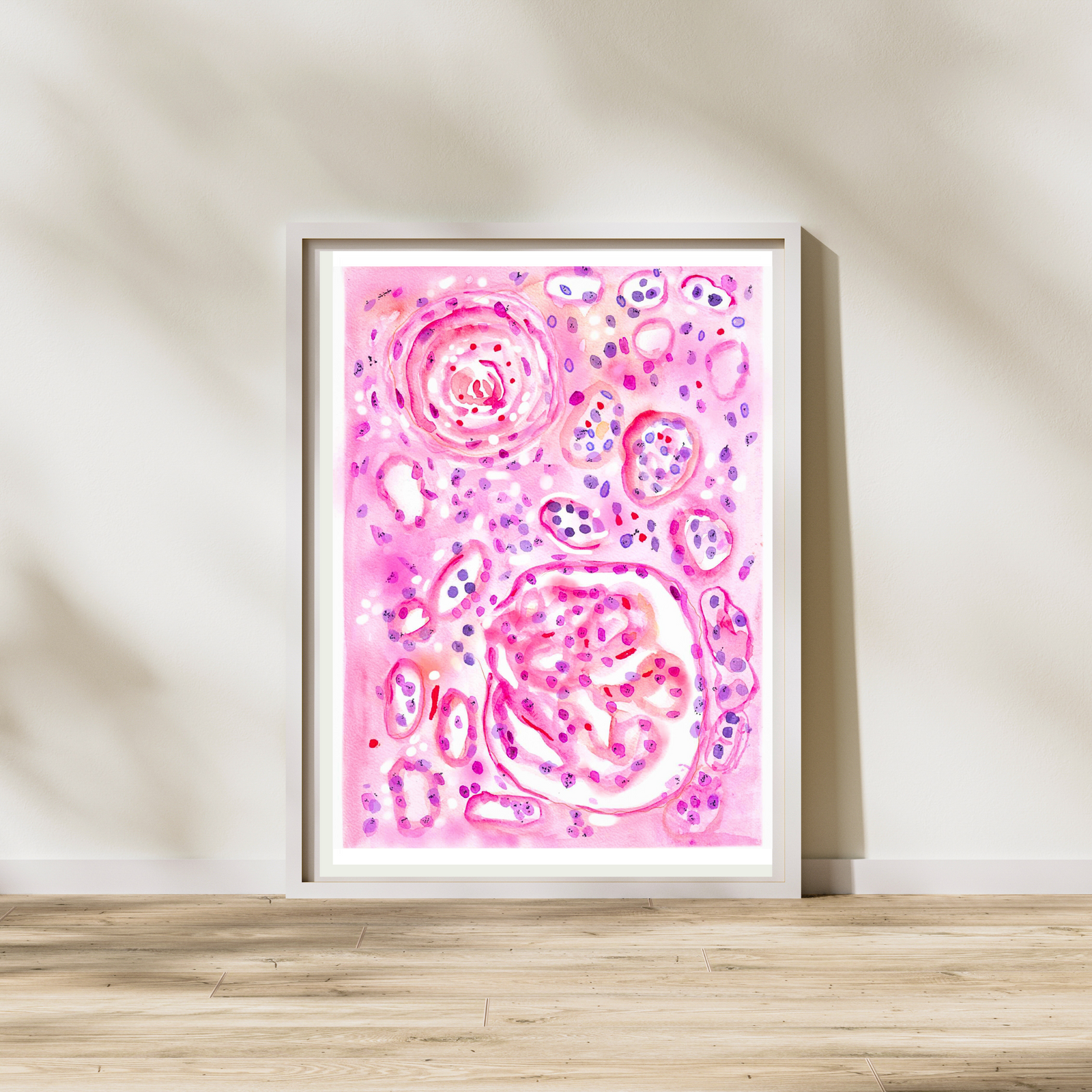 Malignant Nephrosclerosis Histopathology Art