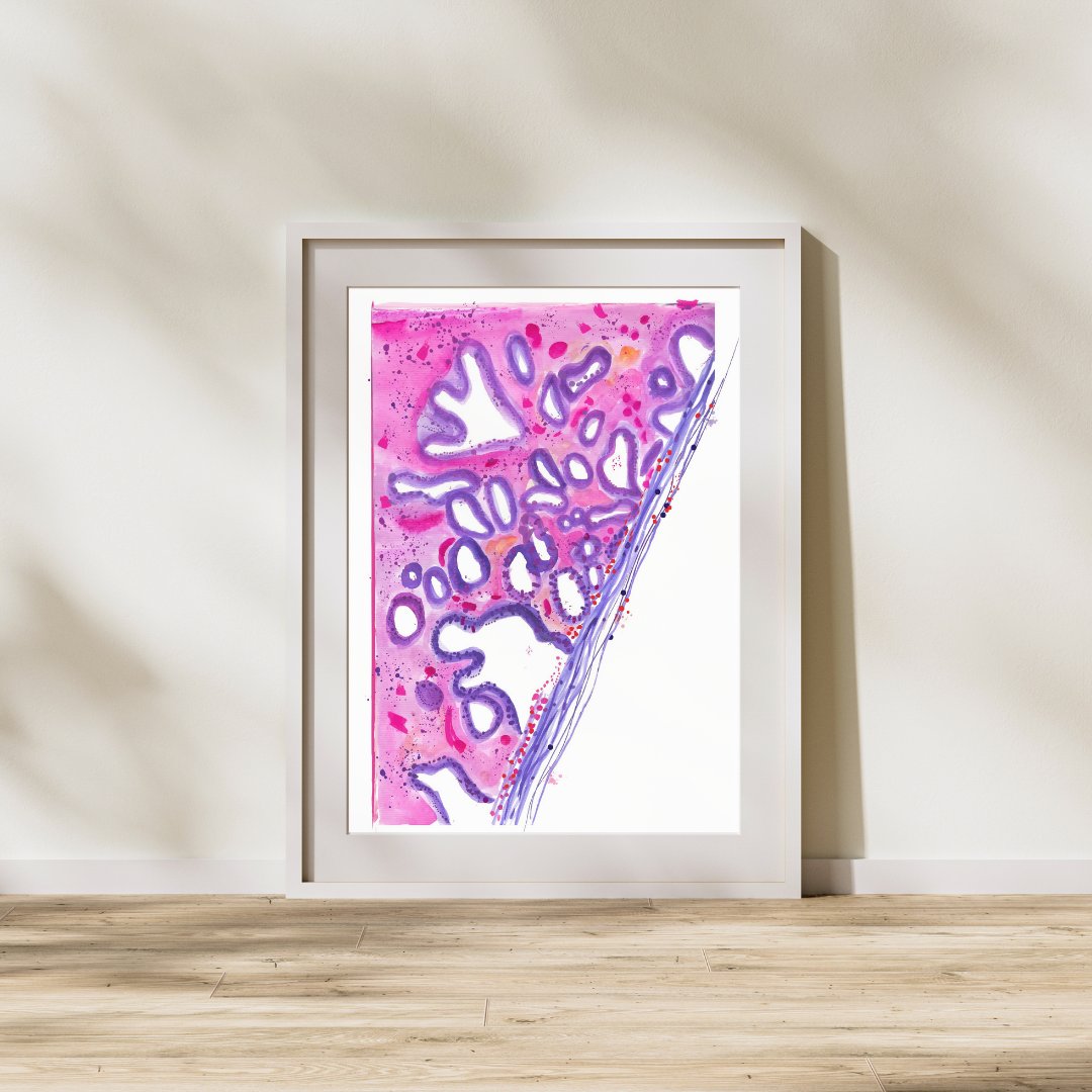 Cervical Cancer Histopathology Art