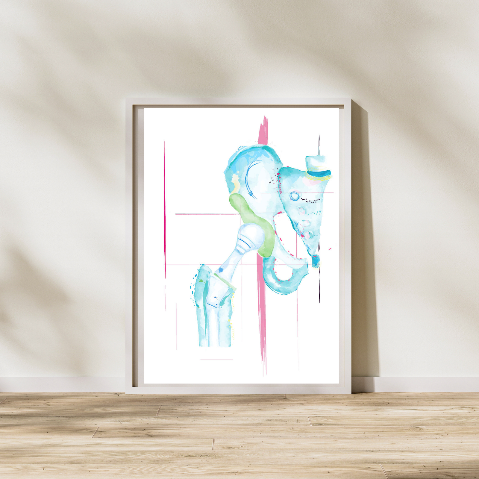 Hip Replacement Orthopedic Anatomy Art