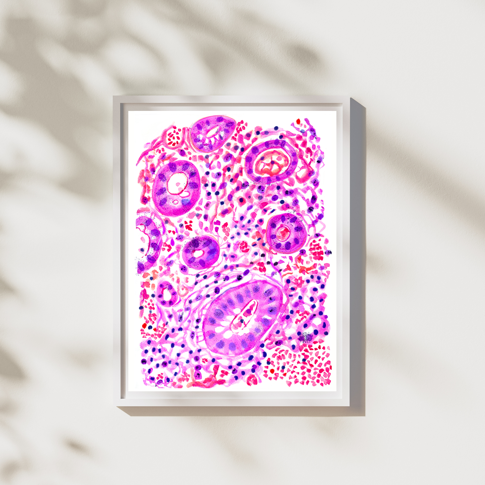 colitis ulcerosa art print