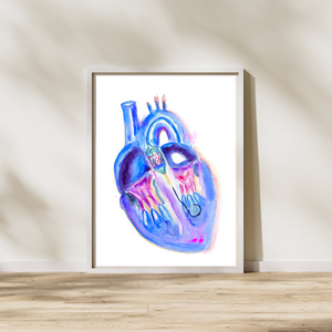 Transaortic Valve Replacement Watercolor Art Print