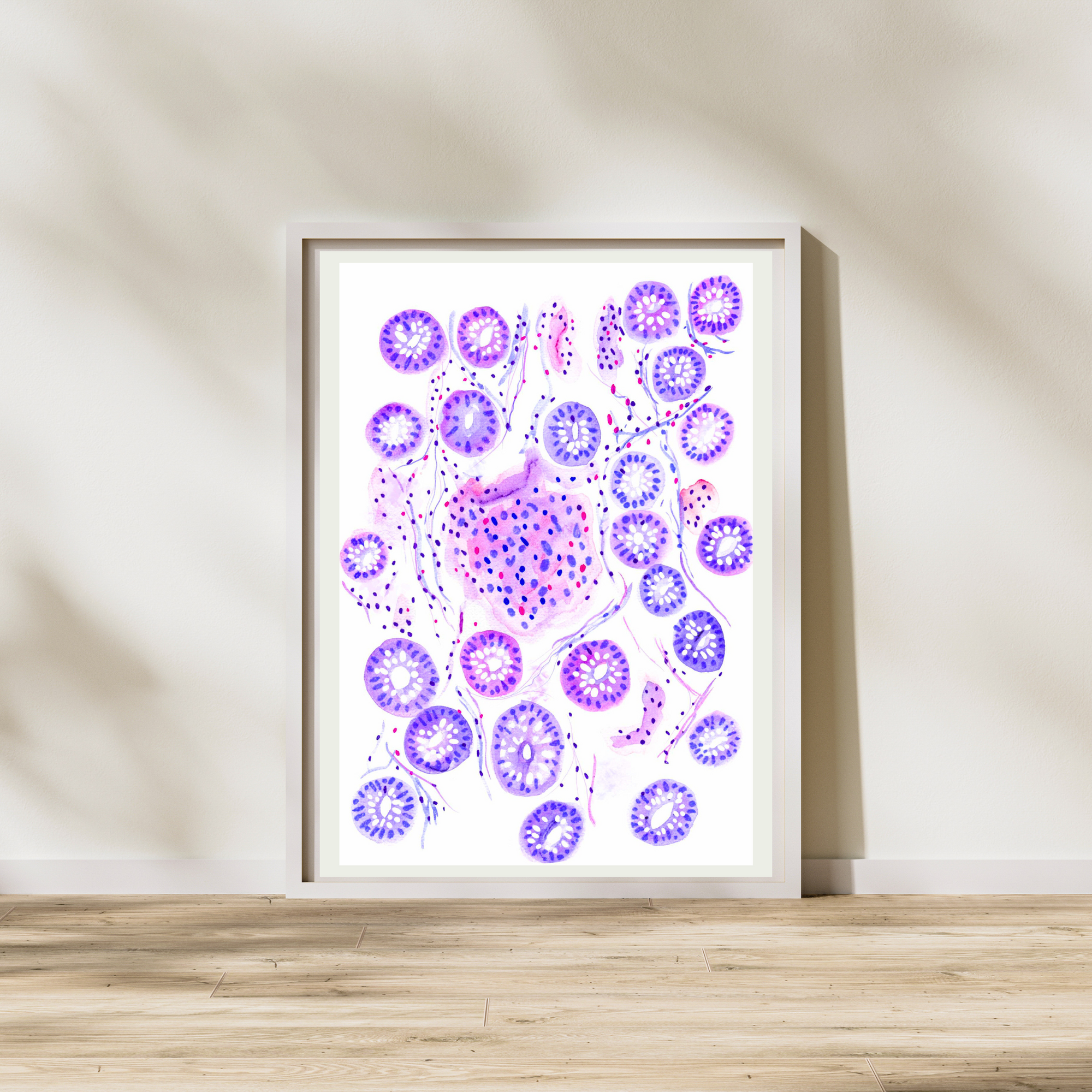 Crohn´s Disease Histopathology Art Print