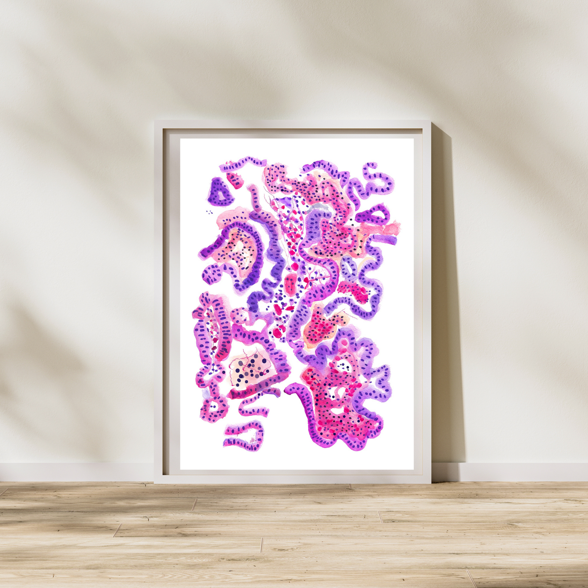 Cholangiocarcinoma Hepatobiliary Cancer Pathology Watercolor Print