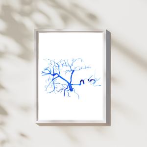 Celiac Trunk Arteriogram Interventional Radiology Vascular Gastroenterology Surgery Art Print