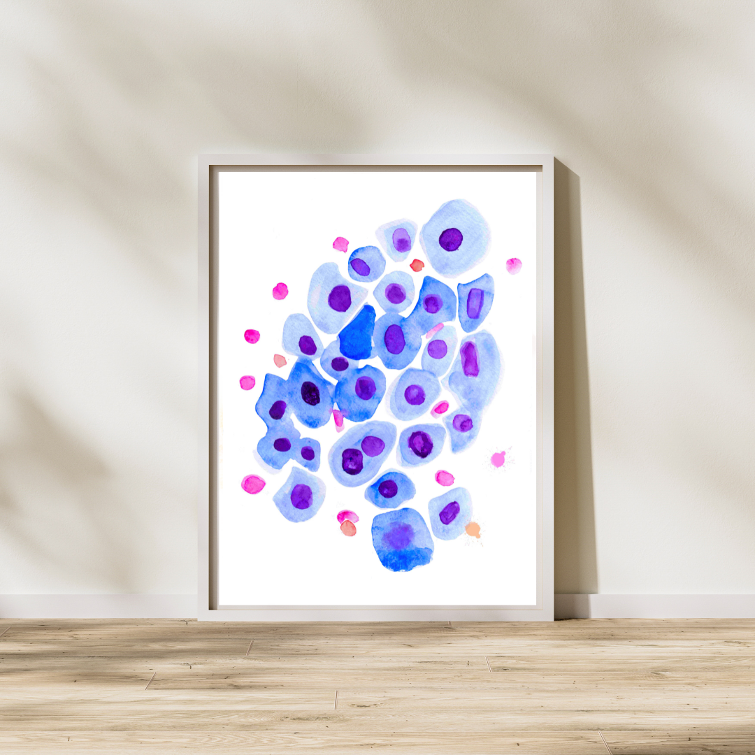 bronchial wash cytology art print