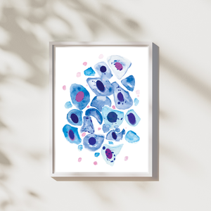 Bronchial Wash Pathology, Pulmonology Art Print