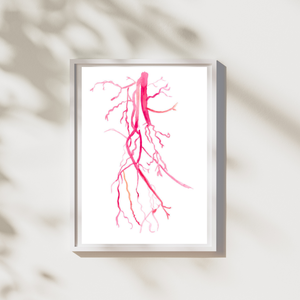 Angiography Femoral Spf Artery Occlusion Anatomy Art Print