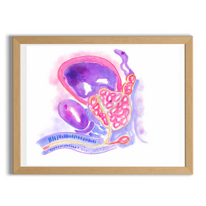 prostate hyperplasia artwork