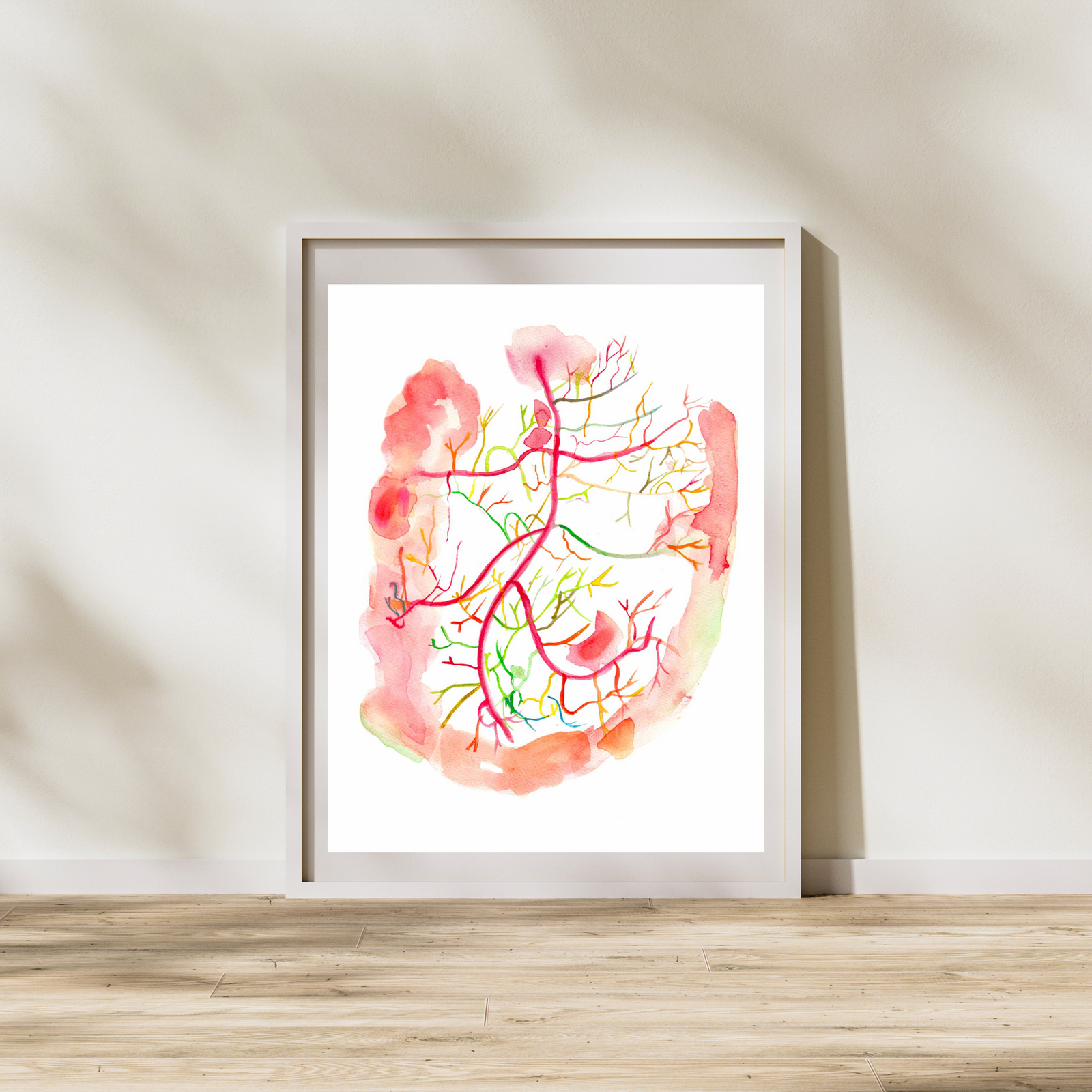 Mesenteric Arteries Angiogram