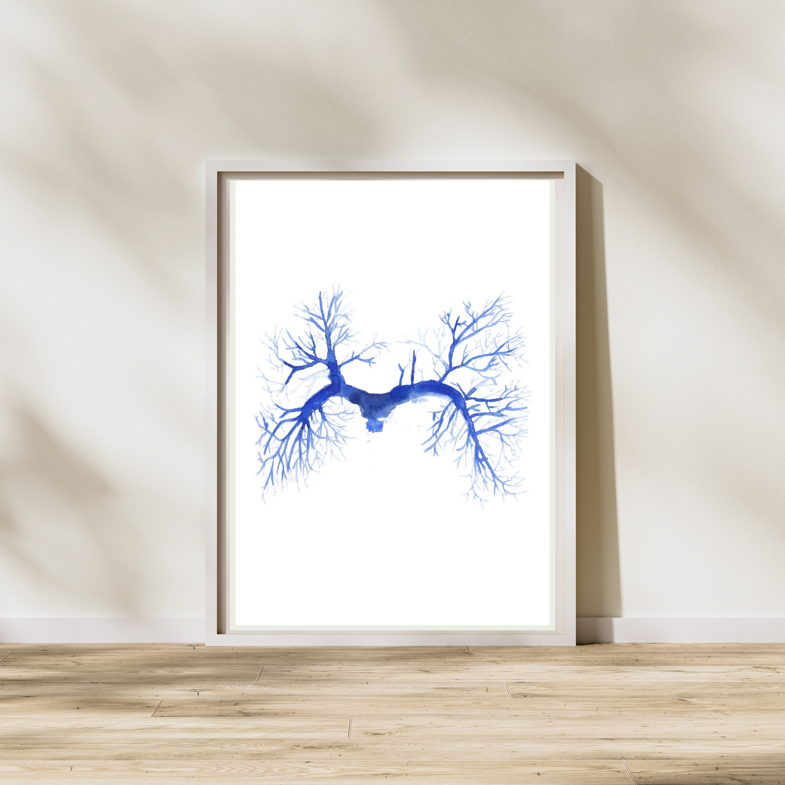 Pulmonary Embolism CT Angiography Watercolor Art Print