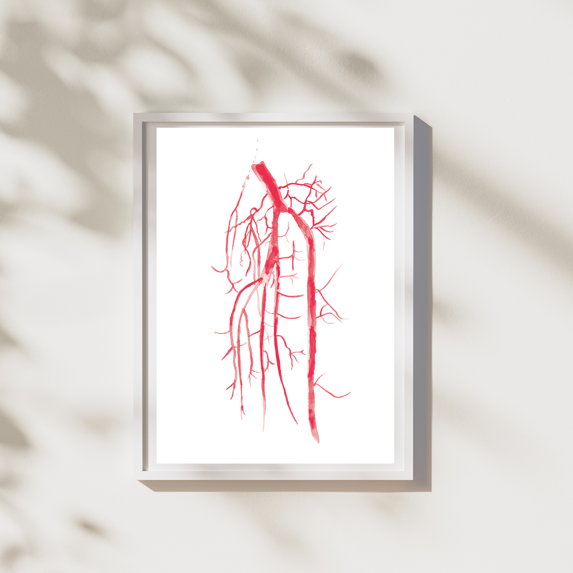 interventional radiology wall decor