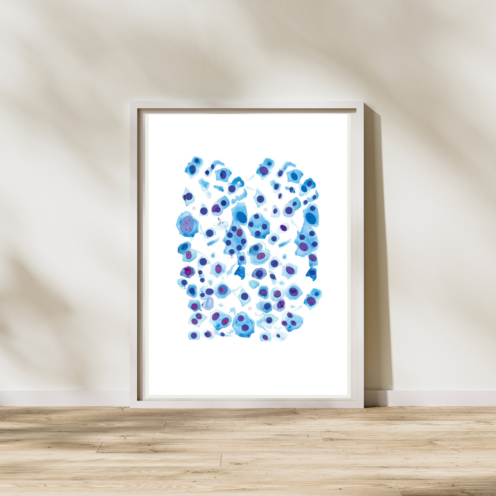 Skin Cell Art Print, Melanoma Art, Dermatology Office Wall Decor, Pathology Art