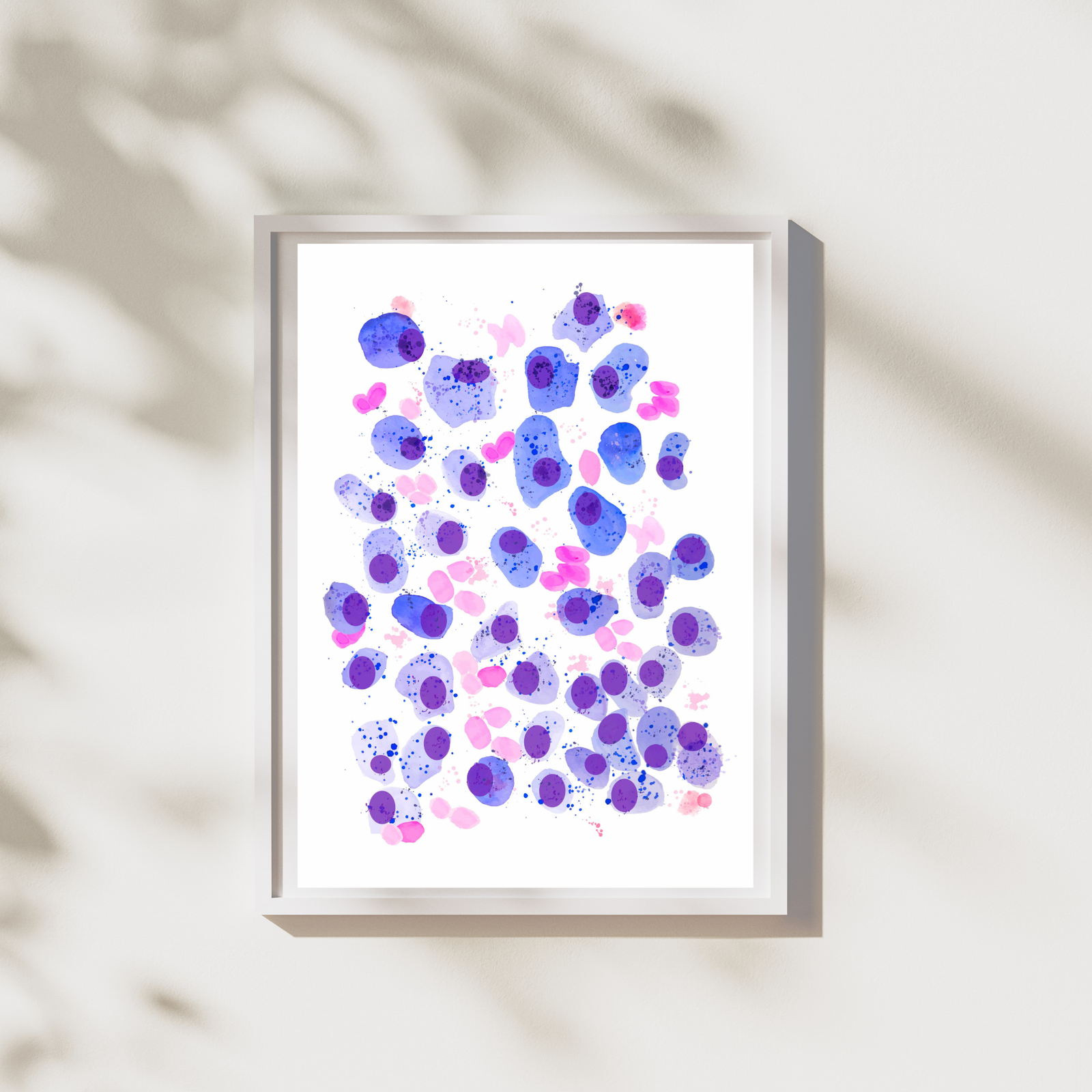 Multiple Myeloma Pathology Art