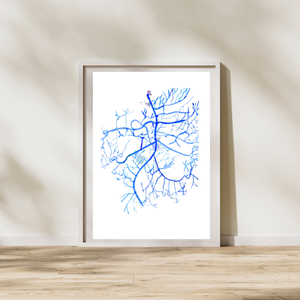 Mesenteric Arteries Angiography