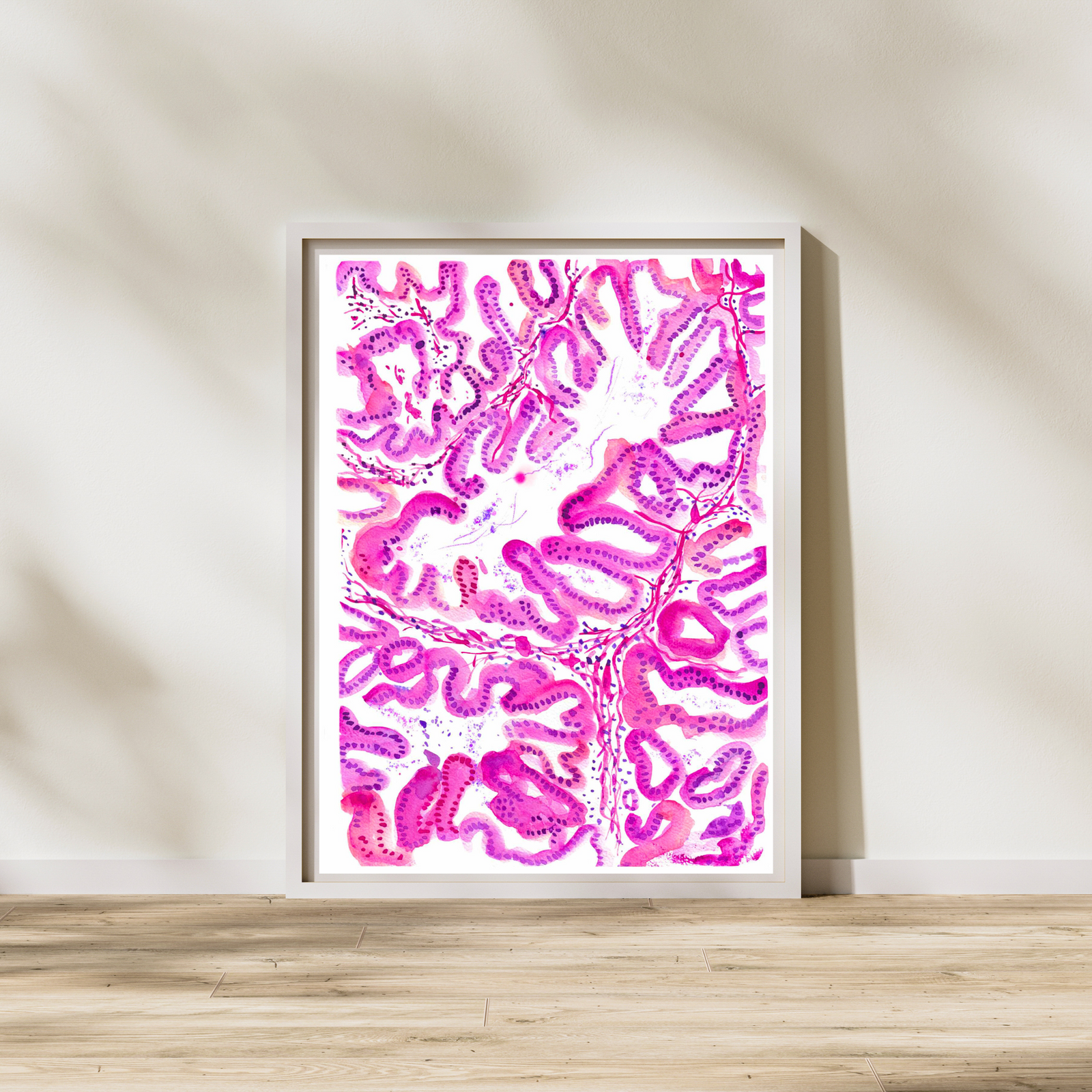 Endometrial Cancer Art Print