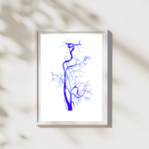 Carotis Angiography,  Radiology Art Print, Neurology Neurosurgery Art, Vascular Surgery Print, Rad Tech Gift, Vascular Anatomy, Radiology