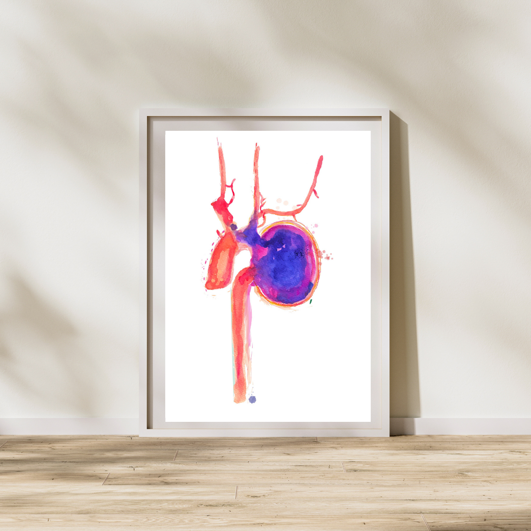 Thoracic Aorta Aneurysm Watercolor Art Print