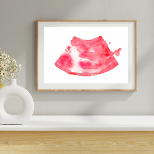 Ultrasound-Guided Popliteal Sciatic Nerve Block Anesthesiology Art