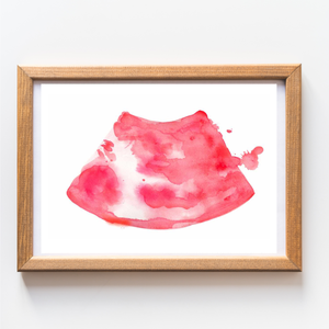 Ultrasound-Guided Popliteal Sciatic Nerve Block Anesthesiology Art