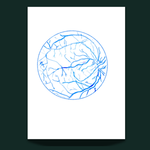 Eye Fluorescein Angiography Ophthalmology Art