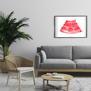 Anesthesia - Ultrasound-Guided Infraclavicular Brachial Plexus Nerve Block