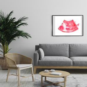 Anesthesia - Ultrasound-Guided Sciatic Nerve Block