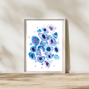 Bronchial Wash Pathology, Pulmonology Art Print