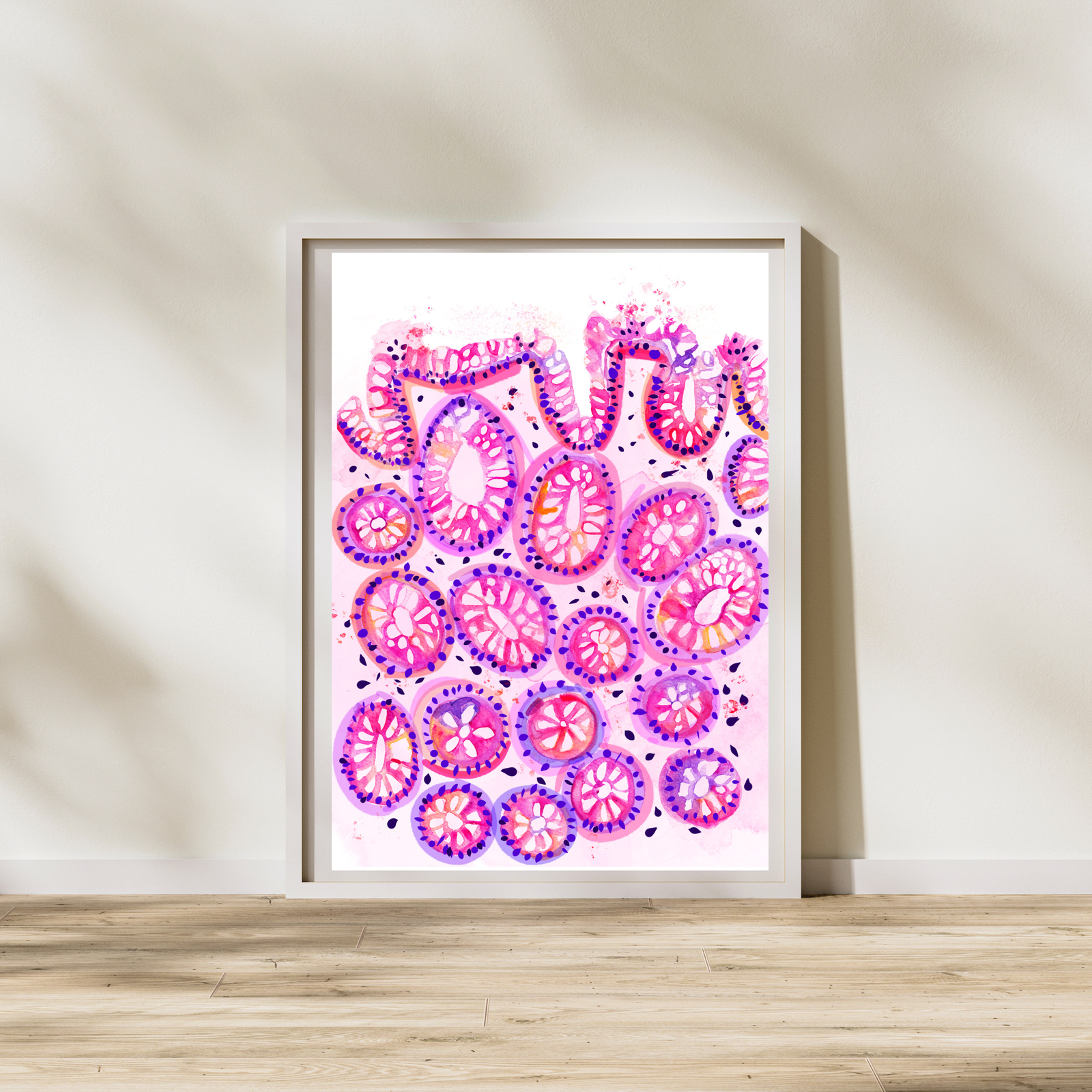 colon polyp histopathology watercolor art print
